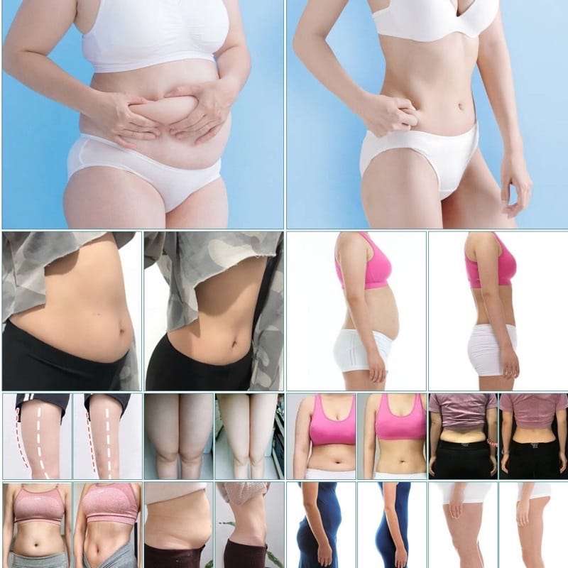 Caffeine Slimming Cream
