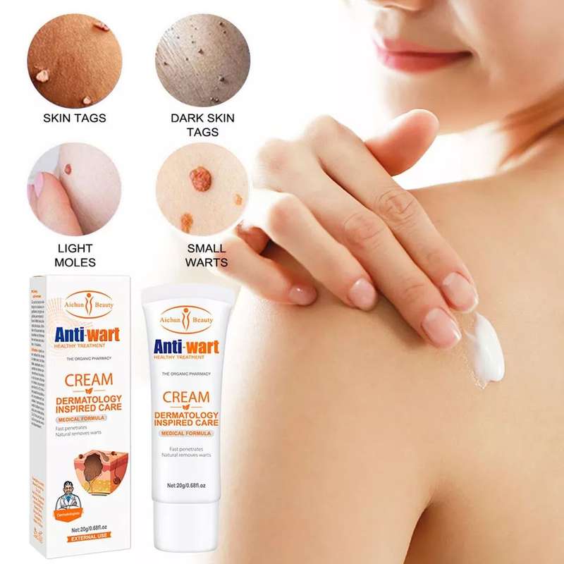 AICHUN BEAUTY | Anti - wart cream
