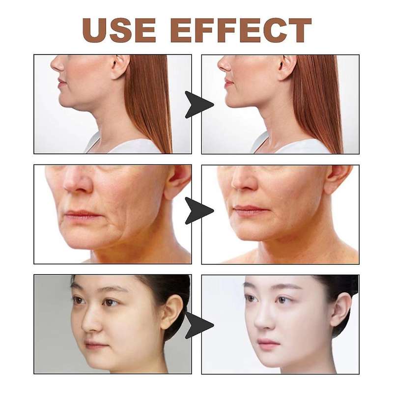 Myofascial Face Tightening Tape