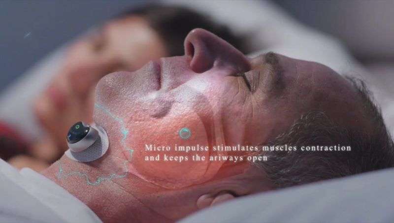 SNORE CIRCLE - Bluetooth Anti-Snore Device Muscle Stimulator