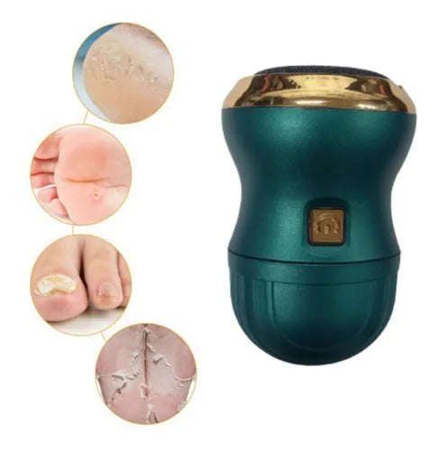 Callus Remover with built in Vacuum