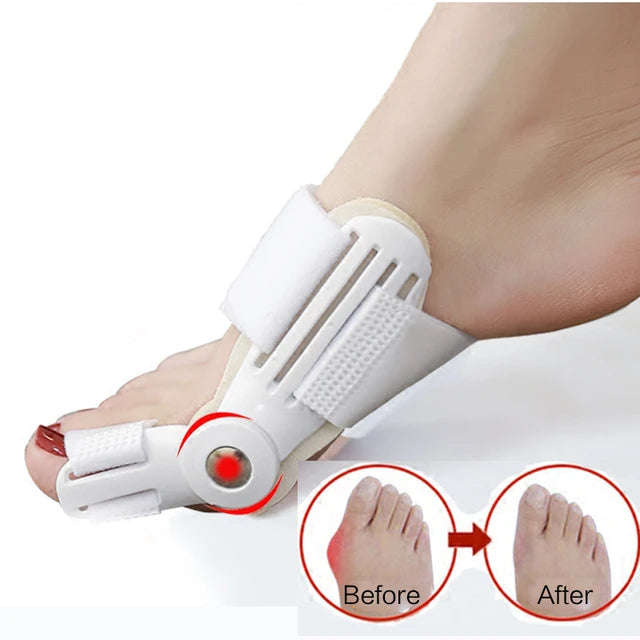 1PCS Hallux Valgus Correction Pedicure Device