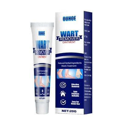 Wart Tags Remover Cream Antibacterial Extract Corn Plaster Warts Ointment