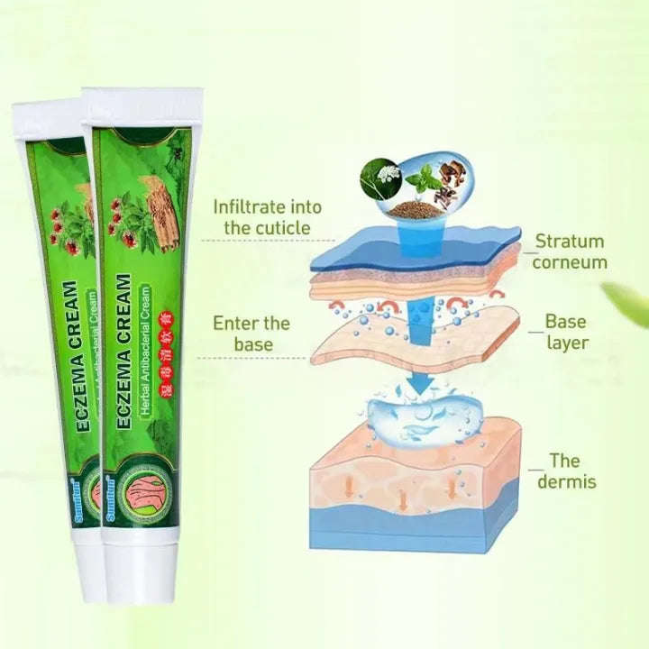 Effective Sumifun Eczema Treatment Cream gamot sa kati kati sa balat buni Psoriasis Treatment Cre...
