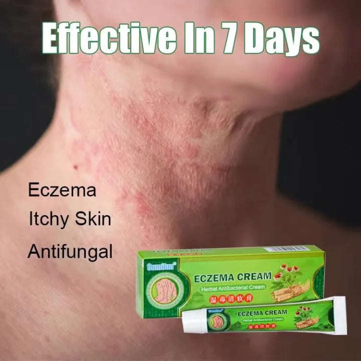 Effective Sumifun Eczema Treatment Cream gamot sa kati kati sa balat buni Psoriasis Treatment Cre...