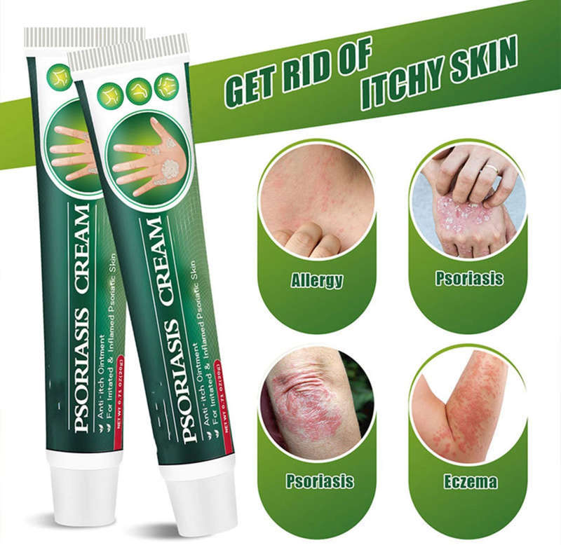 Skinmedix Psoriasis Cream, Zlimplify Psoriasis Cream, Psoriasis Control Face and Body Cream, Natu...