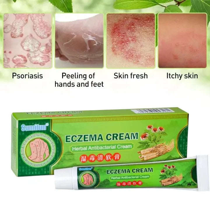 Effective Sumifun Eczema Treatment Cream gamot sa kati kati sa balat buni Psoriasis Treatment Cre...