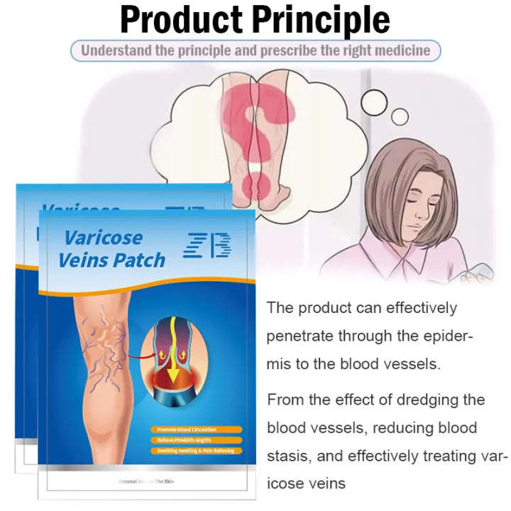 Varicose vein cream Suitable for people with vasculitis, varicose veins, etc Effective swelling a...