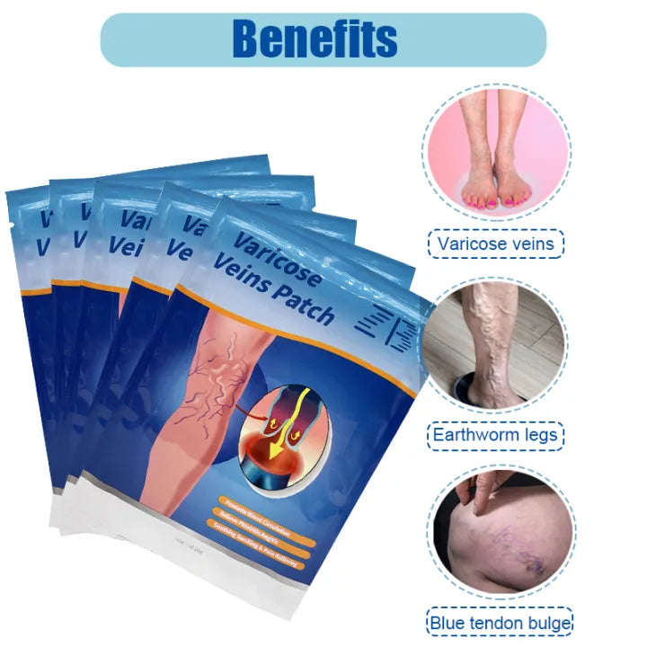 Varicose vein cream Suitable for people with vasculitis, varicose veins, etc Effective swelling a...