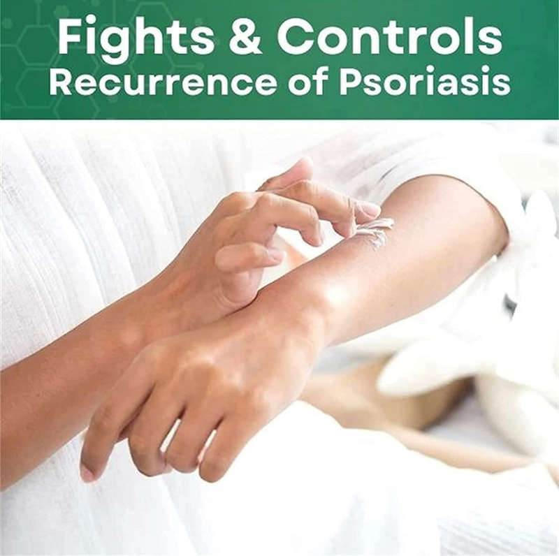 Skinmedix Psoriasis Cream, Zlimplify Psoriasis Cream, Psoriasis Control Face and Body Cream, Natu...