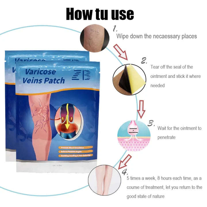 Varicose vein cream Suitable for people with vasculitis, varicose veins, etc Effective swelling a...