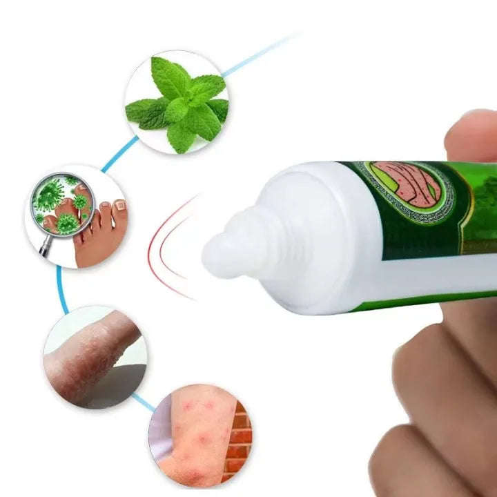 Effective Sumifun Eczema Treatment Cream gamot sa kati kati sa balat buni Psoriasis Treatment Cre...