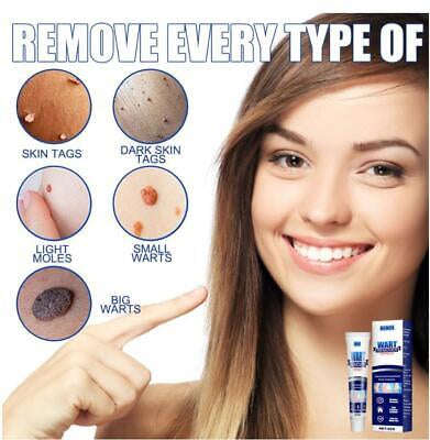 Wart Tags Remover Cream Antibacterial Extract Corn Plaster Warts Ointment