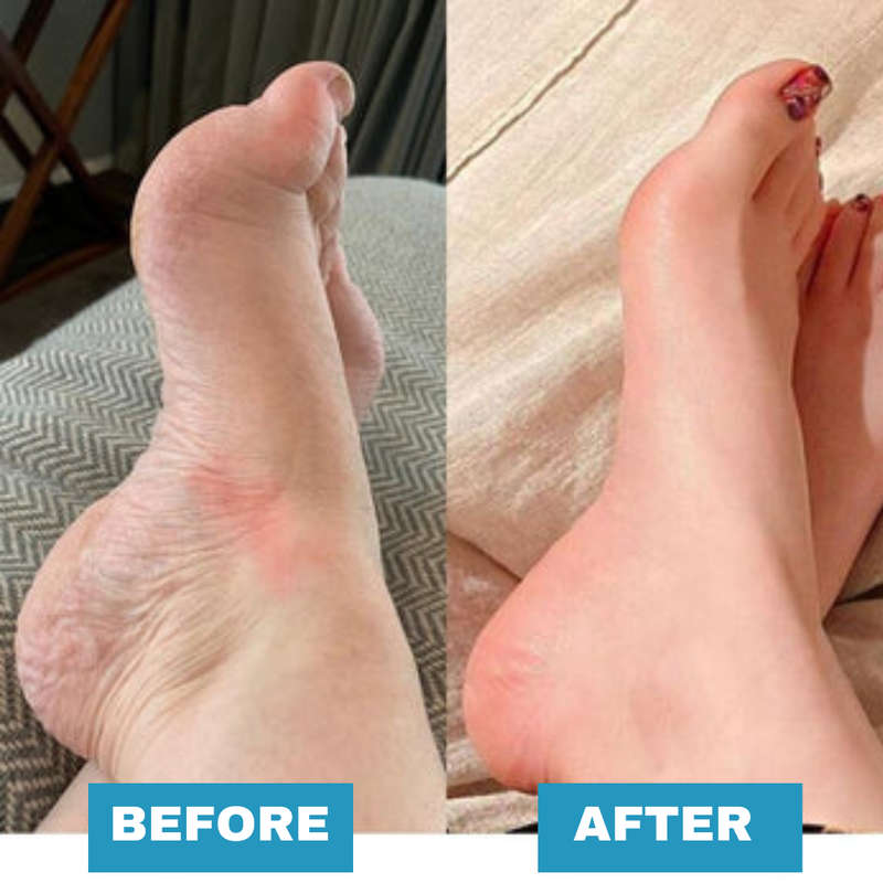EMS  Foot Massager