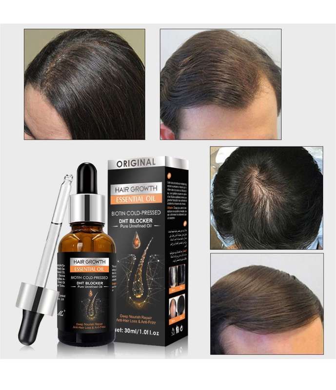Hair Growth Essential Oil Biotin Cold-Pressed DHT Blocker