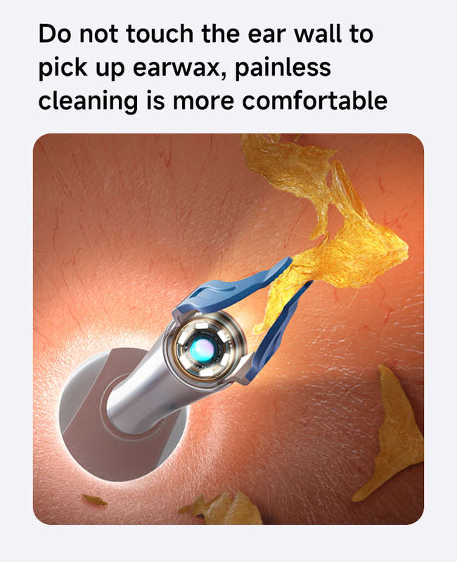 Bebird EarSight Plus Ear Cleaning Wax Removal Tool Kit With Camera