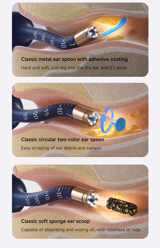 Bebird EarSight Plus Ear Cleaning Wax Removal Tool Kit With Camera