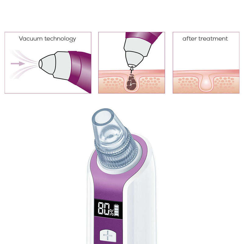 Beurer Pore Cleanser: Power Deep Vacuum Cleanser Rechargeable via USB - FC 41