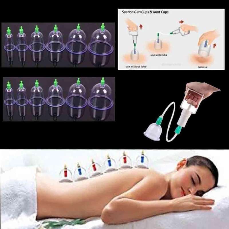 ZS - Vacuum Cupping Sets of 12 Cups With Pump