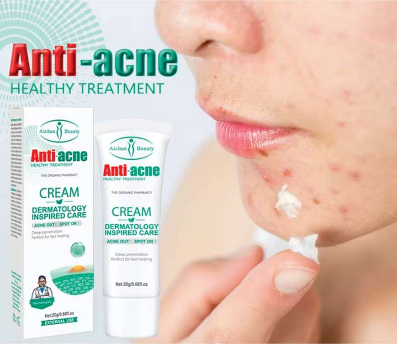 Aichun Beauty Anti-Acne Cream 20g - AC2001