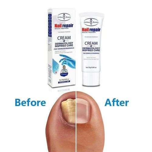 Nail Repair Cream Restores Fungus Infection Damaged Nails -  Aichun Beauty for Effective Toenail ...