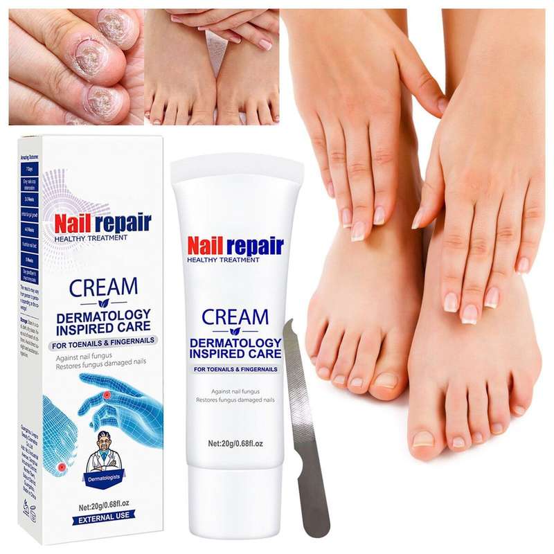 Nail Repair Cream Restores Fungus Infection Damaged Nails -  Aichun Beauty for Effective Toenail ...