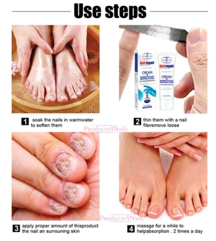 Nail Repair Cream Restores Fungus Infection Damaged Nails -  Aichun Beauty for Effective Toenail ...