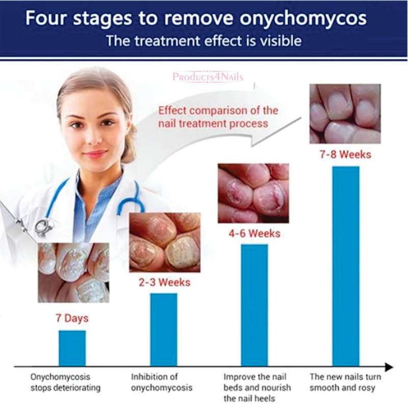 Nail Repair Cream Restores Fungus Infection Damaged Nails -  Aichun Beauty for Effective Toenail ...