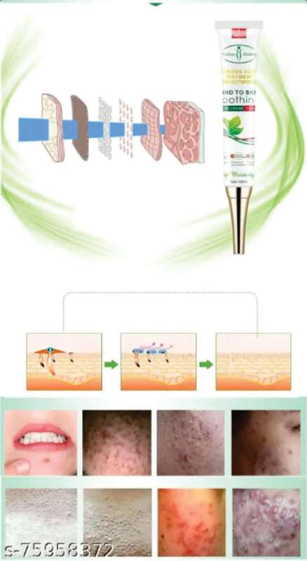Aichun Beauty, Strong Acene ointment Acene Outispot on, Acene Cream 3 days Acne out, Spot on 30ml