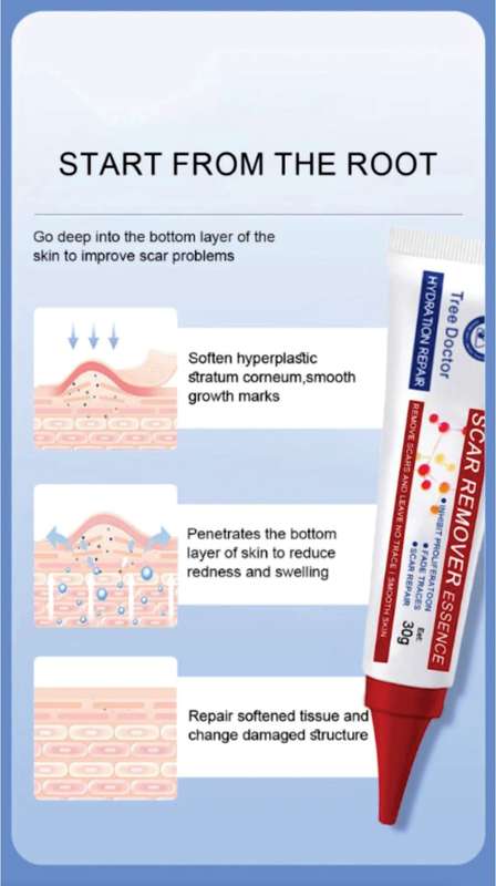 Tree Doctor Scar Removal Cream 30g - HD-1231