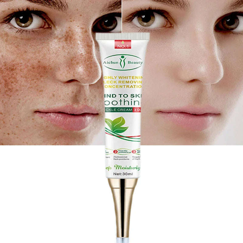 Aichun Beauty, Strong Acene ointment Acene Outispot on, Acene Cream 3 days Acne out, Spot on 30ml