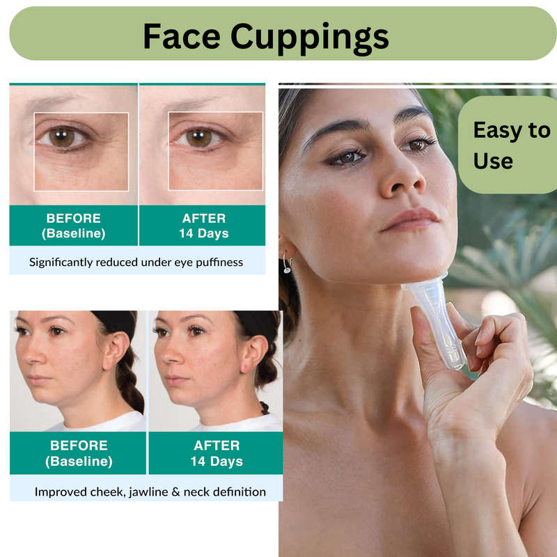Gua Sha, Face Roller & 4 Cuppings for Facial Massage Set, Skin Care Tools