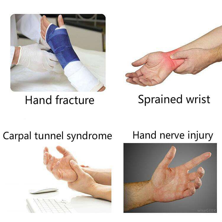 Rehabilitation Fingerboard Adjustable Hand Rest Wrist Support Wrist Fracture Fixation Brace, Styl...