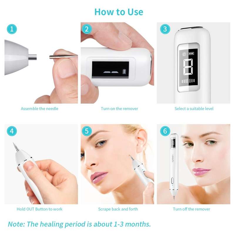 Xpreen XPRE061 Professional Dark Spot Remover Freckle Tattoo Chargeable Wart Mole Remover, with L...