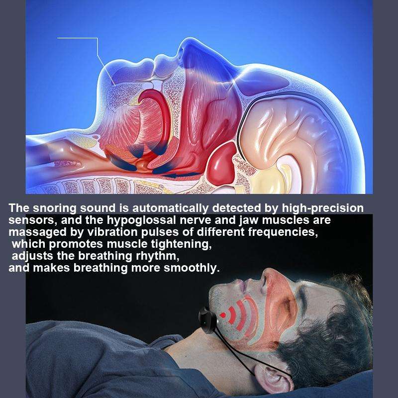USB Rechargeable Smart Anti-snoring Device Home Snoring Corrector(Black)