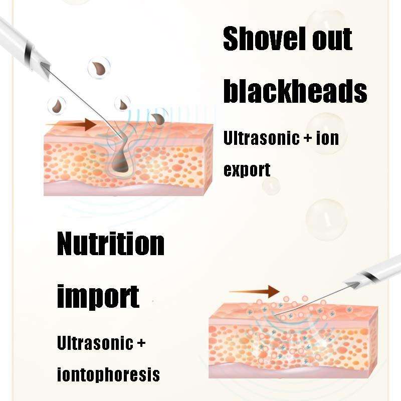 Ultrasonic Ion Shoveling Machine Blackheads Dead Skin and Acne Cleansing Instrument Beauty Introd...