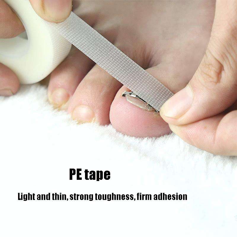 Orthopedic Buckle Toe Nail Groove Ingrown Nail Corrector, Style:No. 38, Specifications:Set