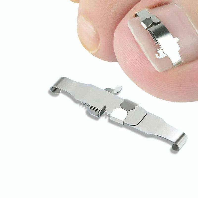 Orthopedic Buckle Toe Nail Groove Ingrown Nail Corrector, Style:No. 36, Specifications:Positive N...