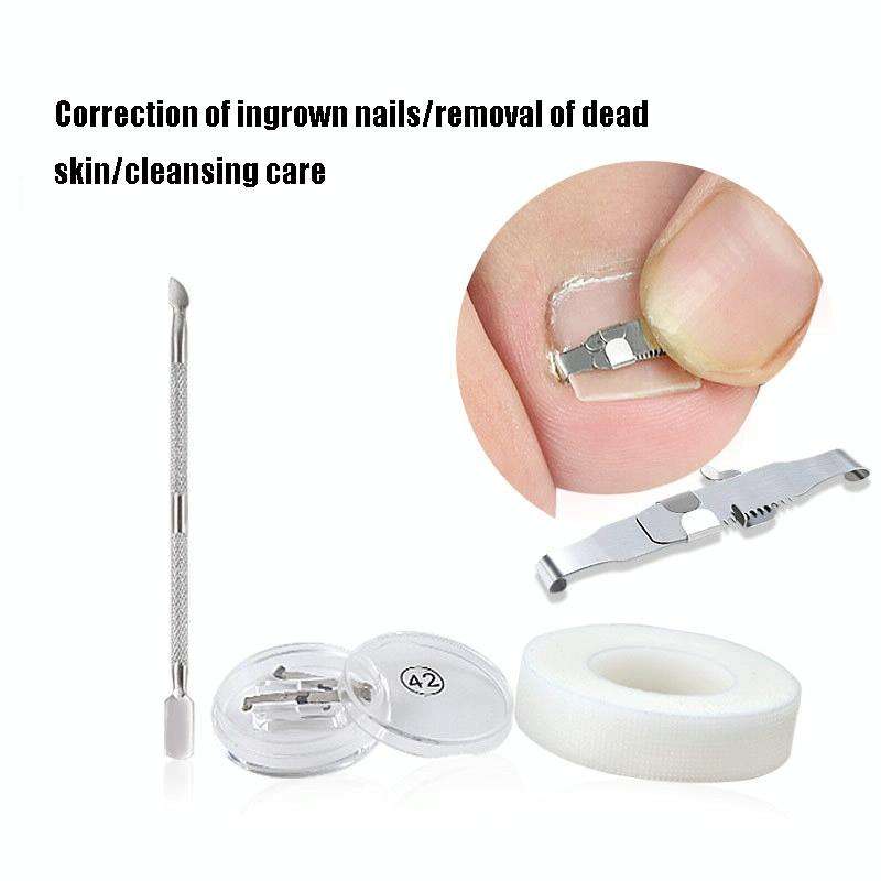 Orthopedic Buckle Toe Nail Groove Ingrown Nail Corrector, Style:No. 38, Specifications:Set