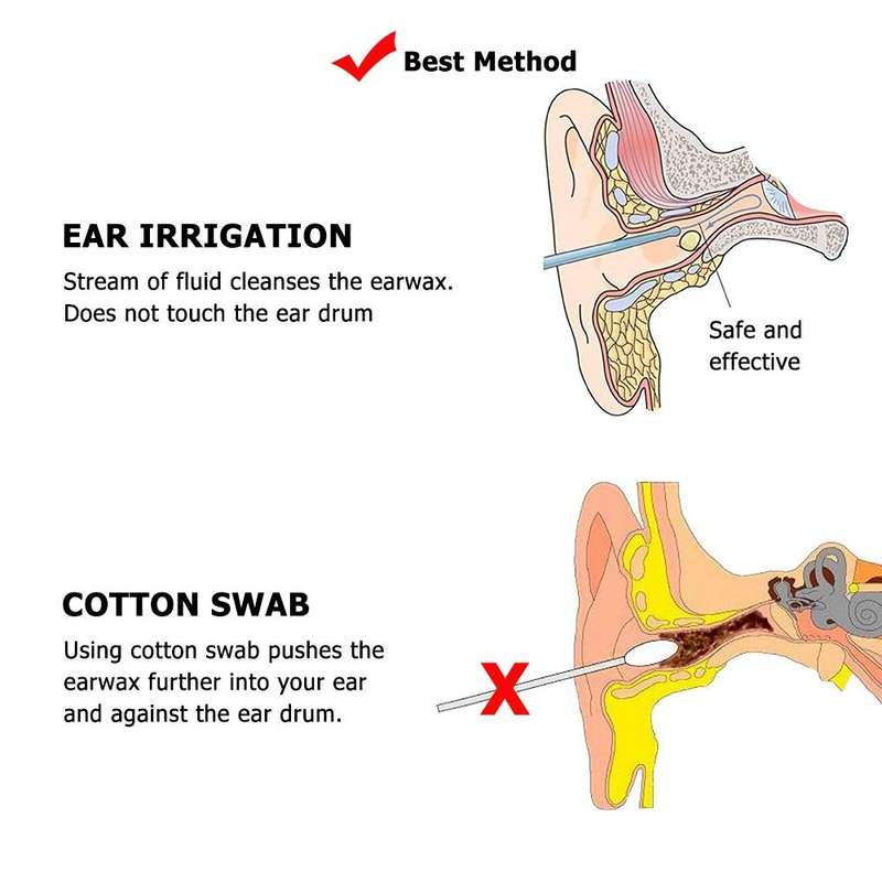 Ear Wash Ball Ear Wash Set Ear Wax Cleaning Tool