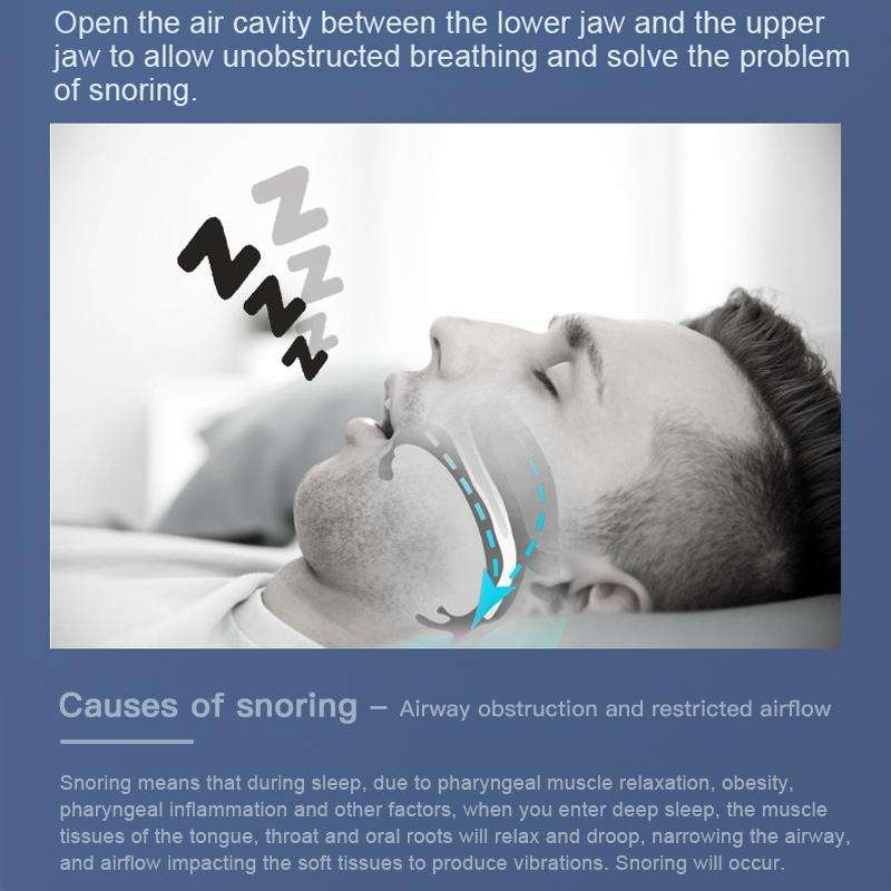 YJK100 Silicone + ABS Stop Snoring Device Anti Snore (Black)