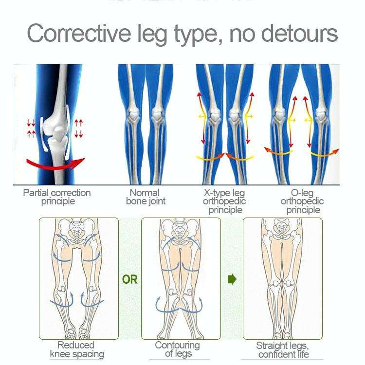 3 PCS/Set Leg Posture Corrector O/X-type Bowlegs Orthotic Bandage Straightening Belt Band, Size: ...