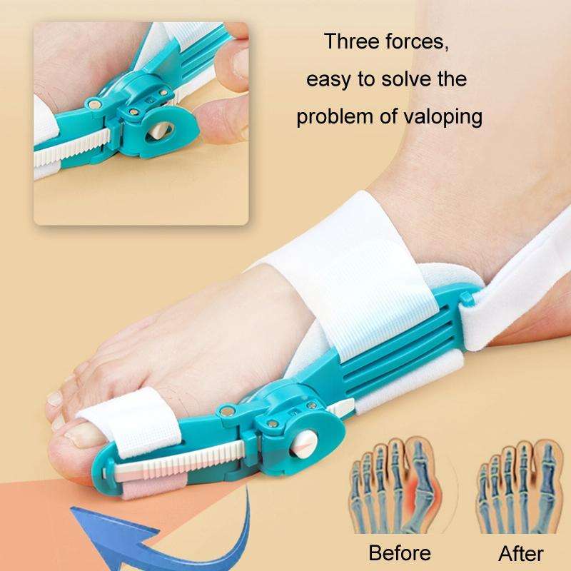 Thumb Valgus Toe Corrector(White)