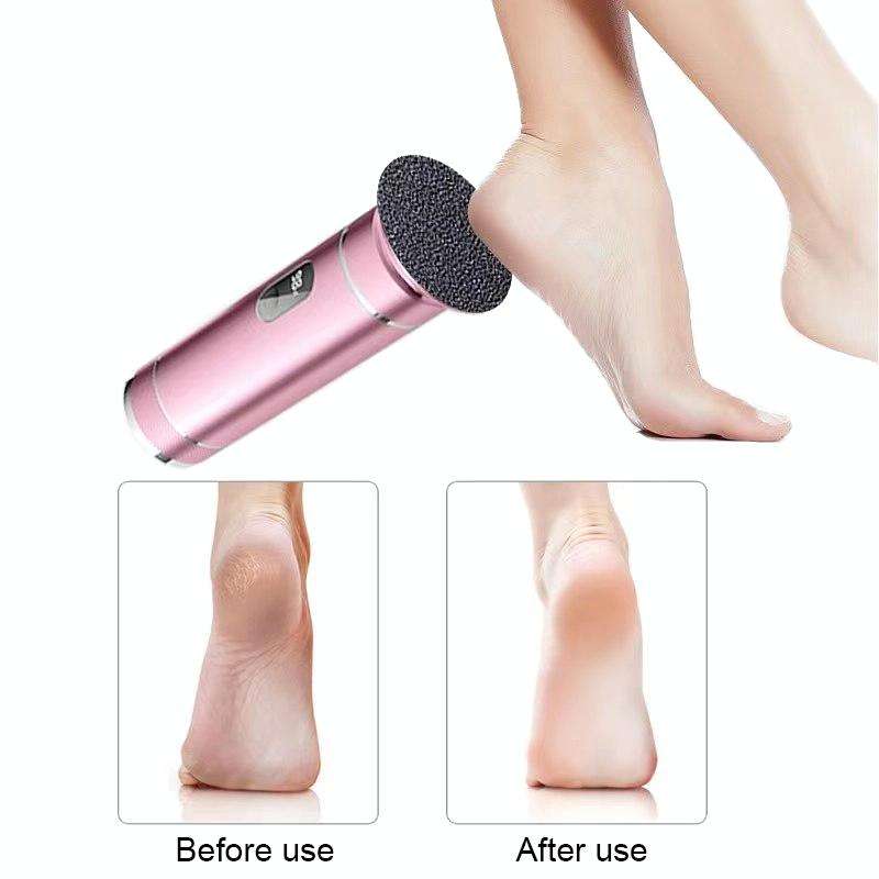 S-608 Smart Digital Display USB Charging Foot Grinder Exfoliating Electric Pedicure(Gold)