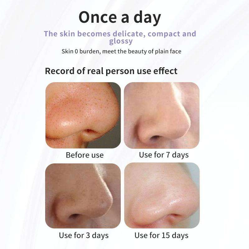 AM-02 Electric Micro Small Bubble Facial Cleasing Machine USB Rechargeable Beauty Device