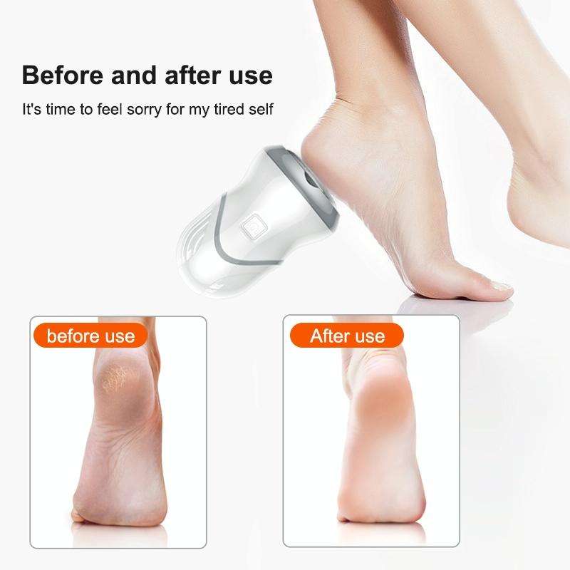 Electric Vacuum Design Foot Grinder Household Multifunctional Pedicure Calluses Foot Care, Specif...