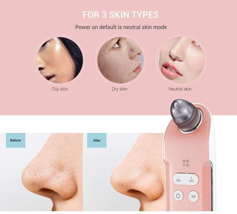 K-SKIN KD803A 3 Level Intensity Blackhead Removal Pore Cleaner Suction Rechargeable Black Spot Cl...