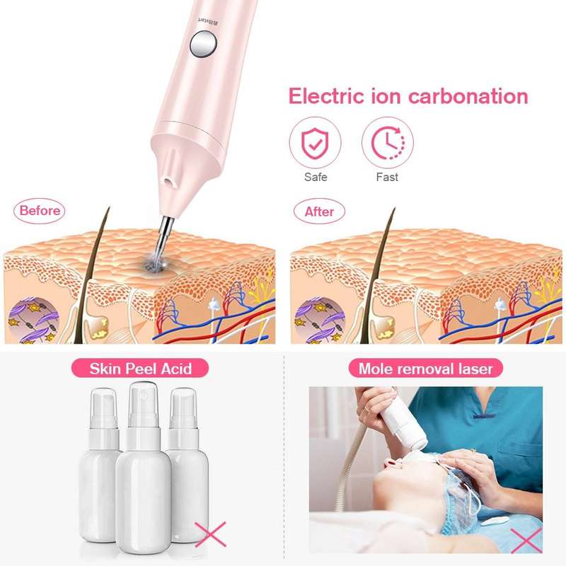 K-SKIN KD306 Laser Spotting Machine Plasma Pen Dark Eyelash Remover for Facial Spasm Removal Tatt...