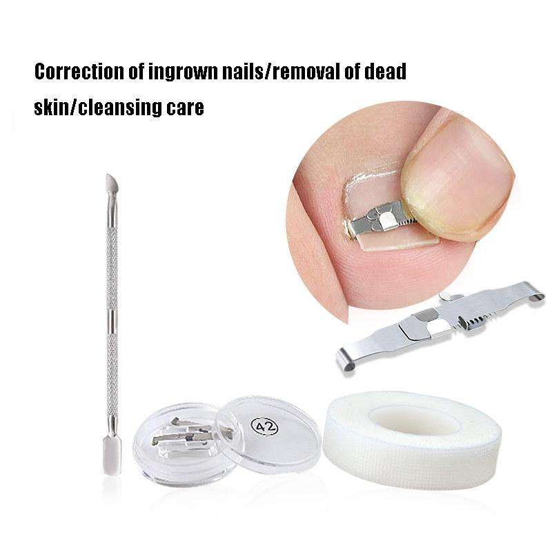 Orthopedic Buckle Toe Nail Groove Ingrown Nail Corrector, Style:No. 44, Specifications:Positive N...