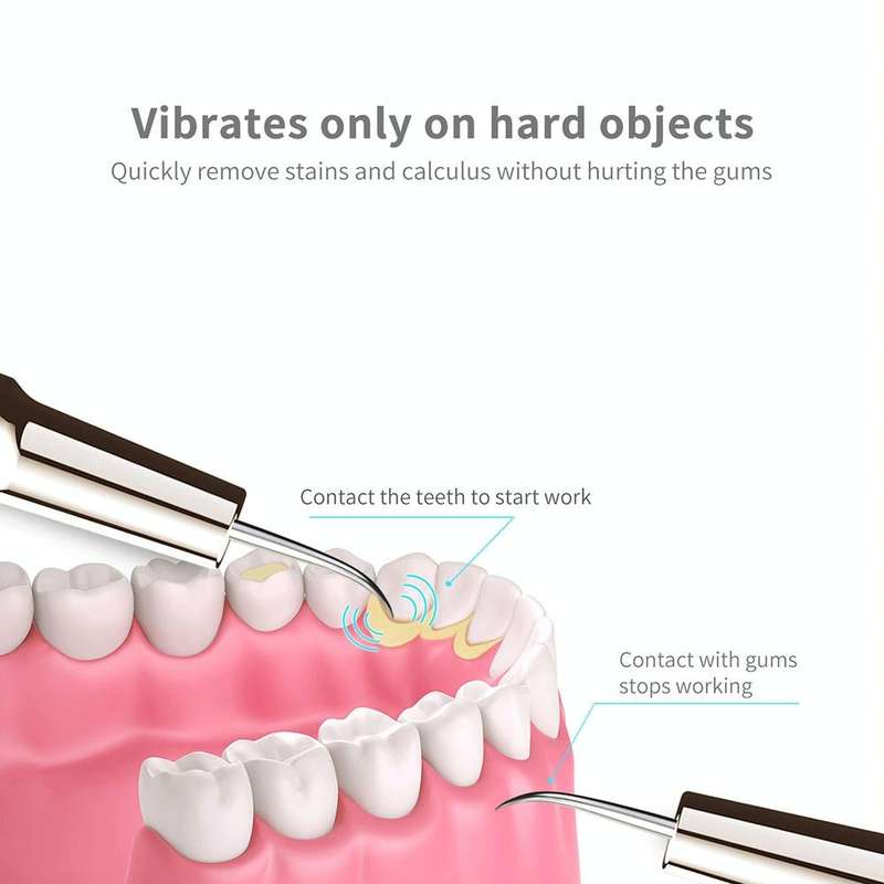Ultrasonic Scaler Household Electric Dental Cleaner Tooth Scaling Machine(Enjoyment Version)